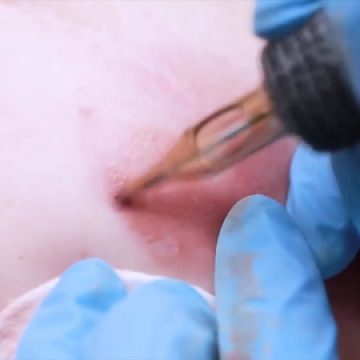 Урок 1 «Имитация ареол на плоском лоскуте кожи»